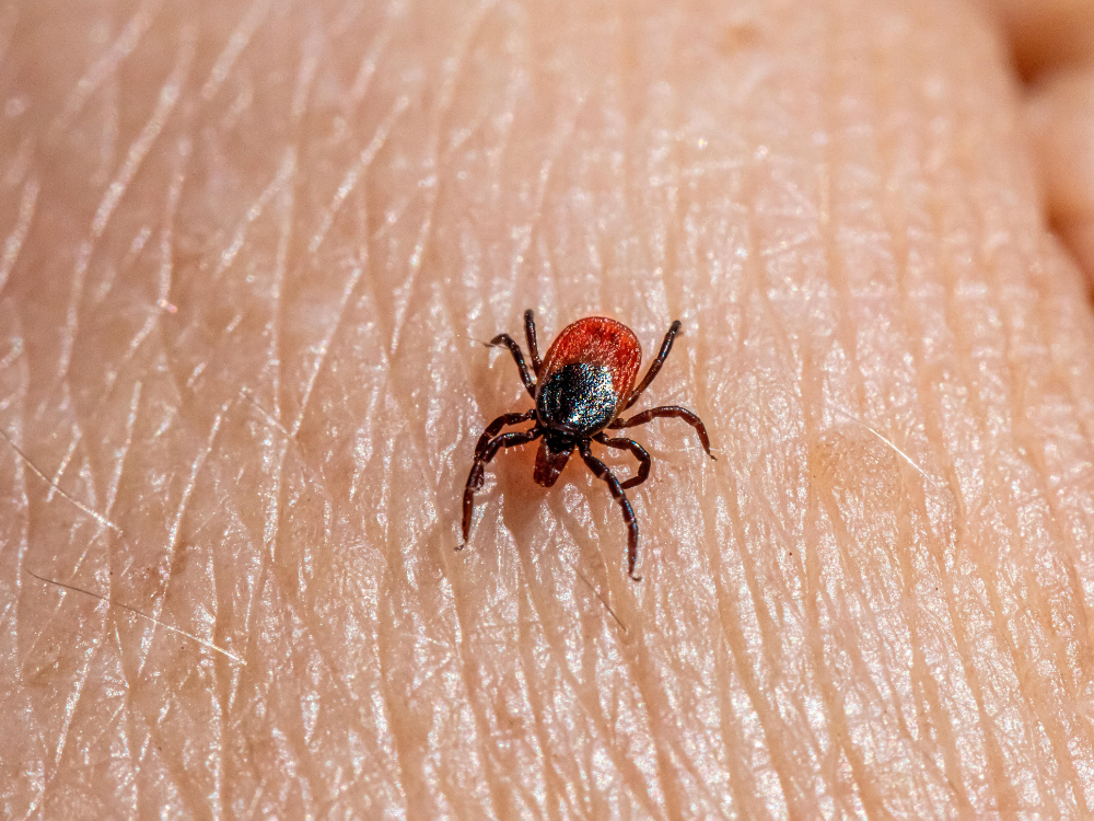 Borelioza i ukąszenie kleszcza. Objawy, usuwanie kleszcza, diagnostyka i leczenie