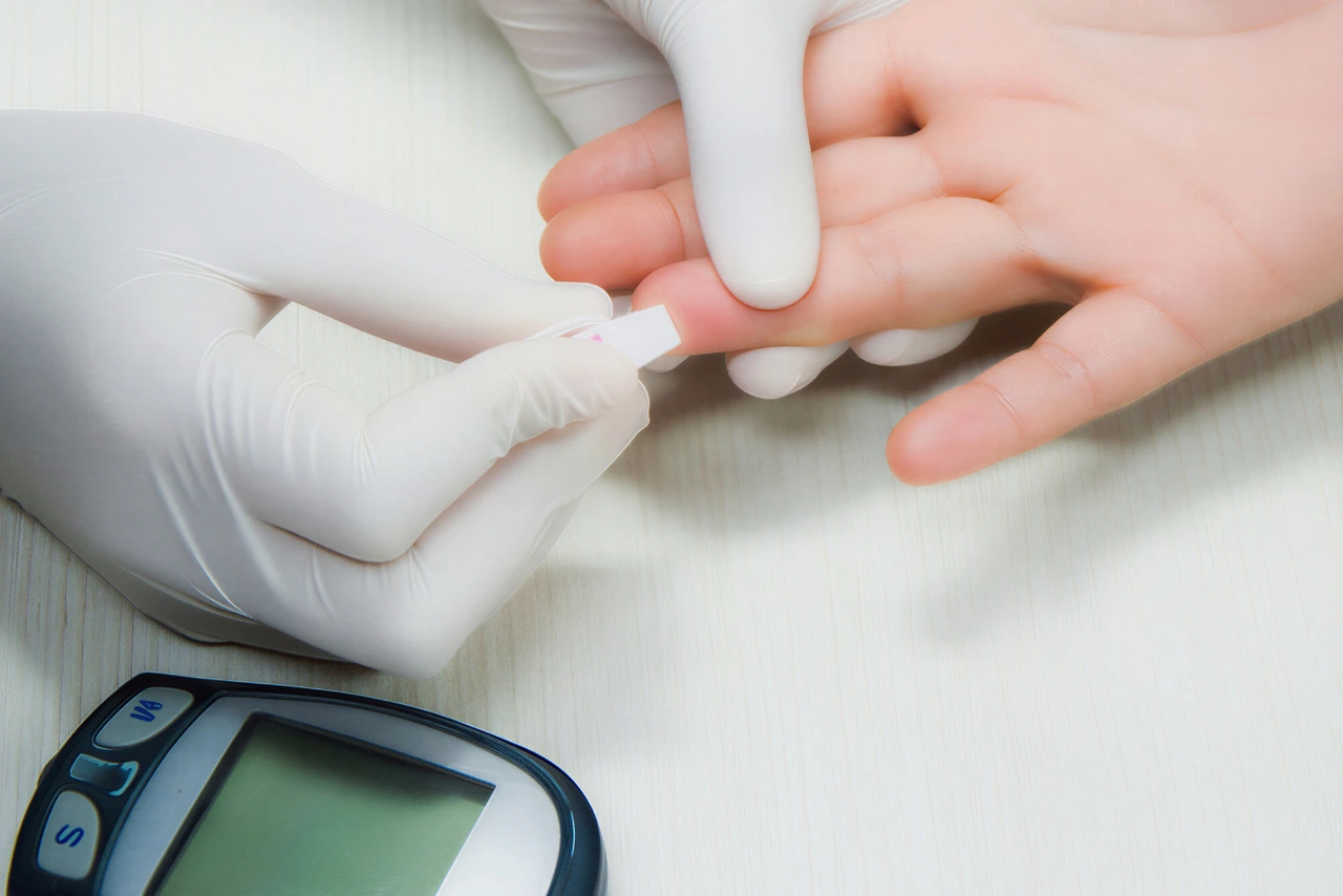 Otyłość a stan przedcukrzycowy – kiedy zaczyna się ryzyko cukrzycy typu 2